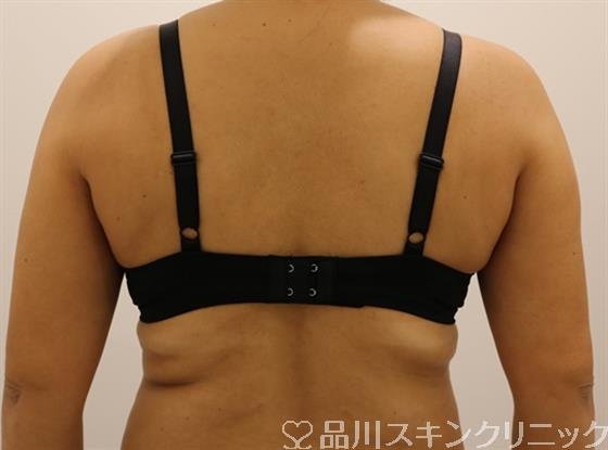症例NO.41257のBEFORE写真