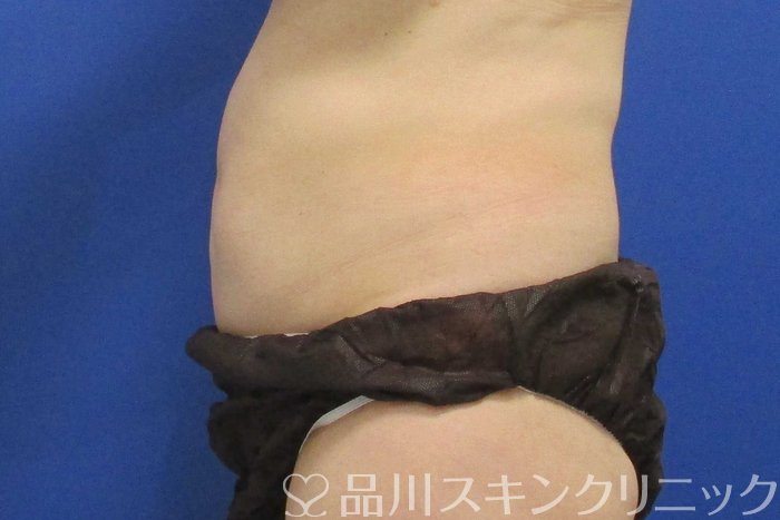 症例NO.70080のBEFORE写真