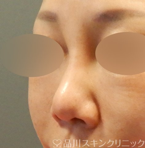 症例NO.64098のBEFORE写真
