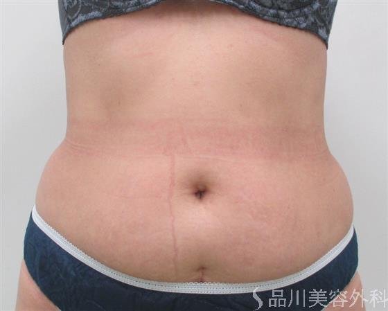 症例NO.22506のBEFORE写真