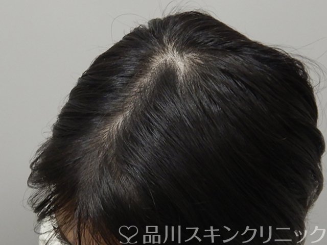 症例NO.69113のAFTER写真