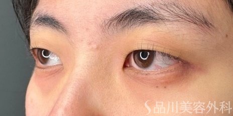 症例NO.73984のBEFORE写真