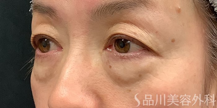 症例NO.71237のBEFORE写真