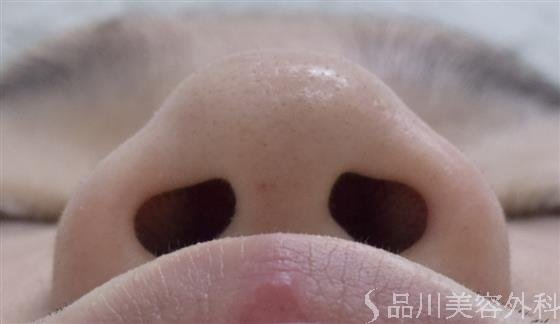 症例NO.47696のBEFORE写真