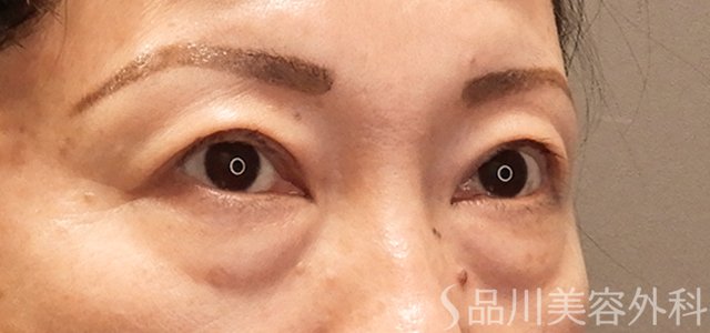 症例NO.73131のBEFORE写真