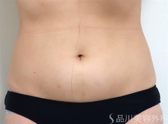 症例NO.35165のAFTER写真