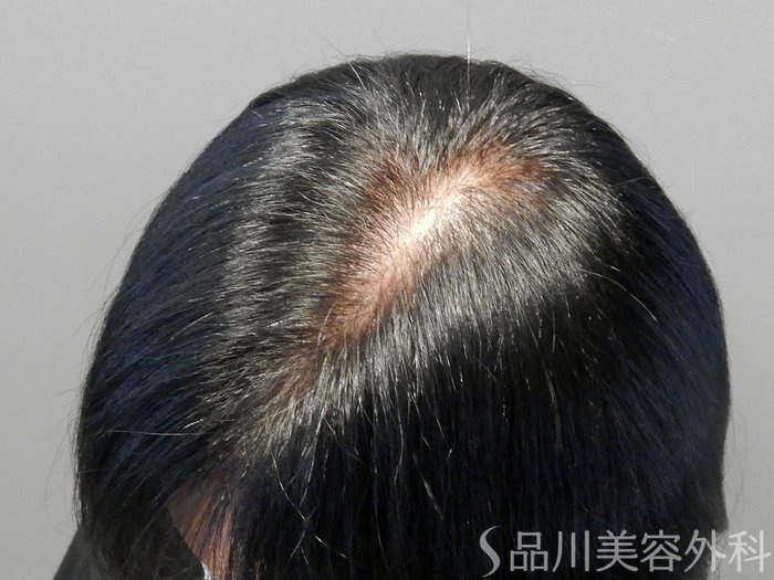 症例NO.69781のBEFORE写真