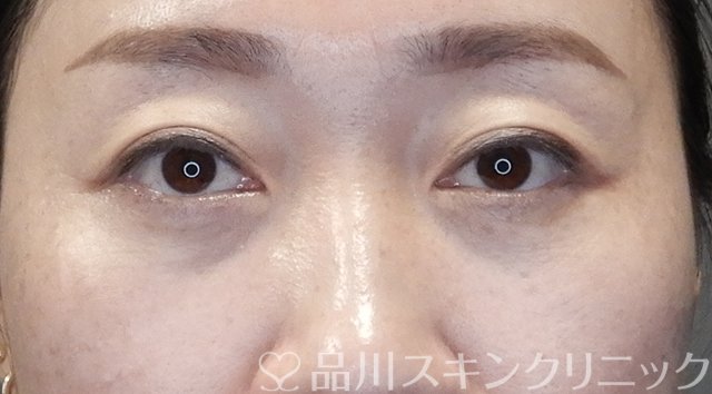症例NO.65295のAFTER写真