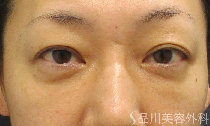 症例NO.69580のAFTER写真