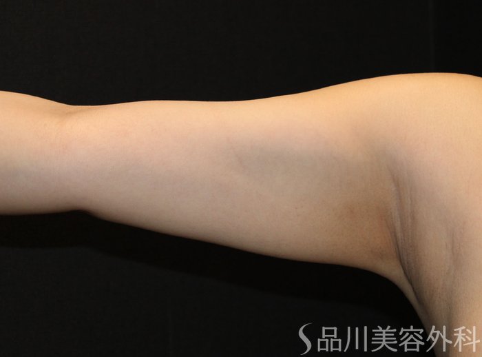症例NO.70976のBEFORE写真