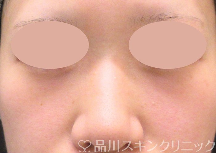 症例NO.73831のAFTER写真