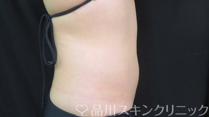 症例NO.70867のAFTER写真