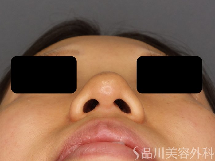 症例NO.73759のBEFORE写真