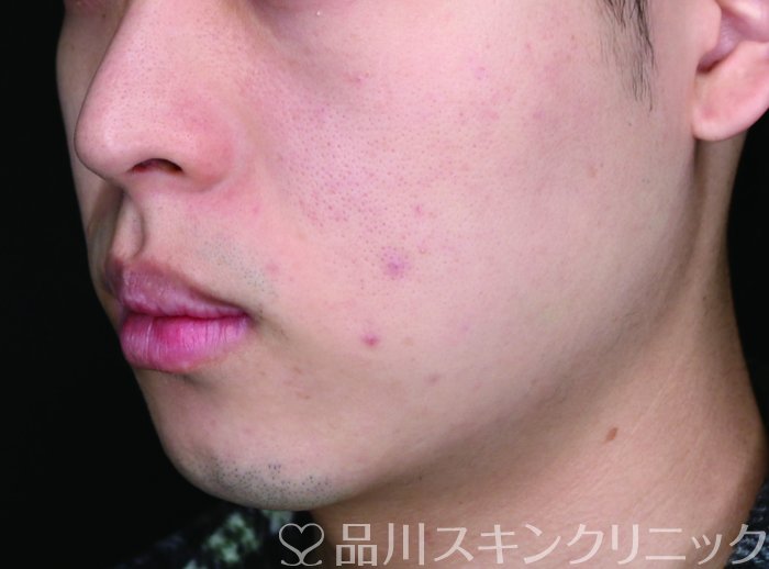 症例NO.67627のBEFORE写真