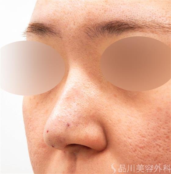 症例NO.53759のAFTER写真