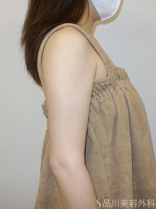 症例NO.73224のAFTER写真