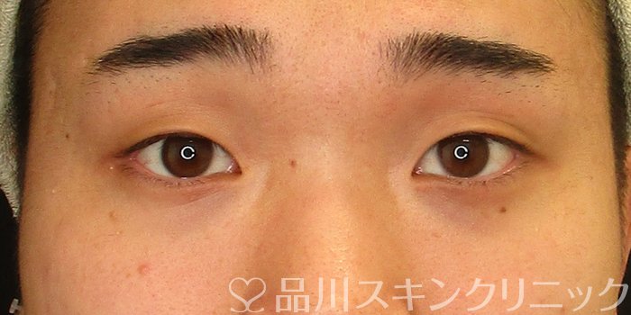 症例NO.73586のBEFORE写真