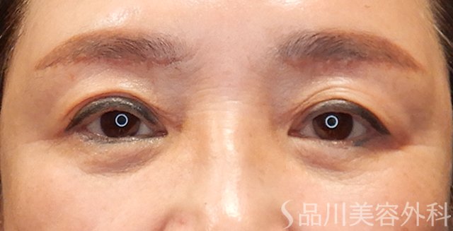 症例NO.73283のAFTER写真