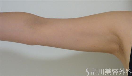 症例NO.47502のAFTER写真
