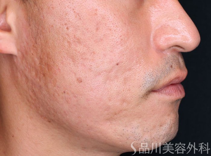 症例NO.73002のBEFORE写真