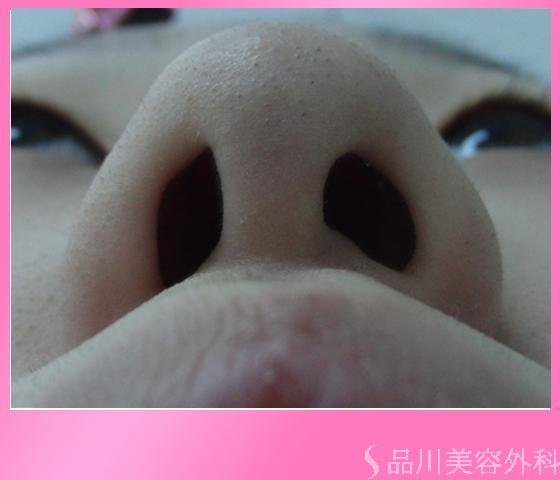 症例NO.7129のBEFORE写真