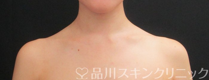 症例NO.73389のBEFORE写真