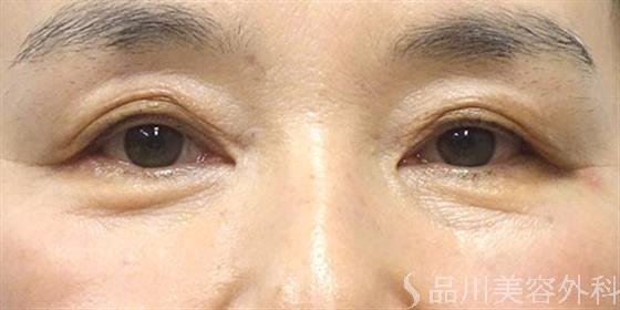 症例NO.21037のBEFORE写真