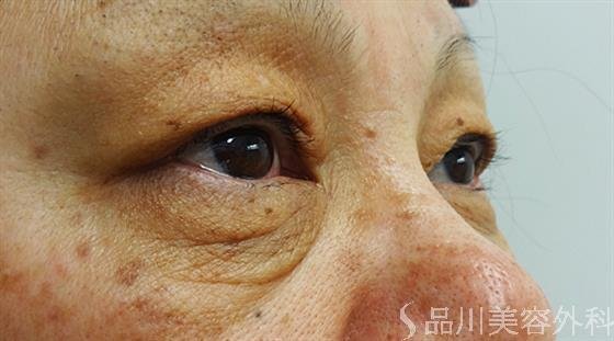 症例NO.30262のBEFORE写真