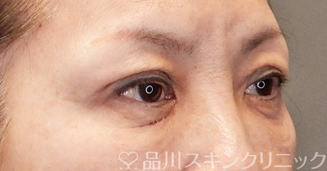 症例NO.65484のAFTER写真