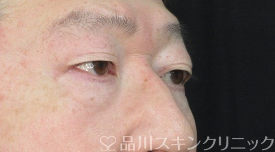 症例NO.72096のBEFORE写真