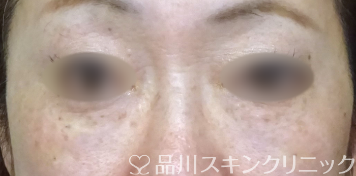 症例NO.69413のAFTER写真