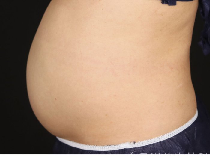 症例NO.73291のBEFORE写真