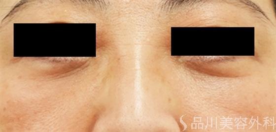 症例NO.39676のAFTER写真