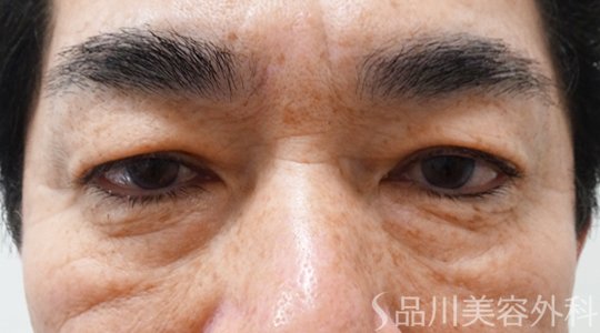 症例NO.69799のBEFORE写真