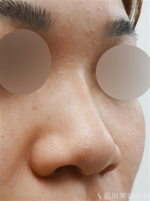 症例NO.30271のBEFORE写真