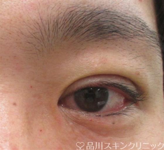 症例NO.27239のAFTER写真
