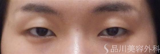 症例NO.16936のBEFORE写真