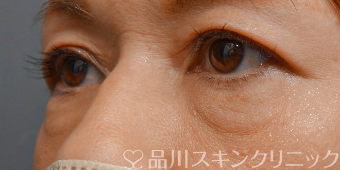 症例NO.71191のBEFORE写真