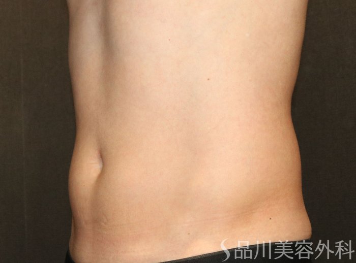 症例NO.74360のBEFORE写真