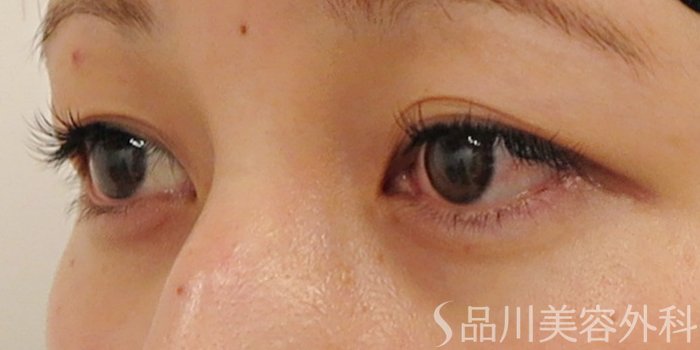 症例NO.70012のBEFORE写真
