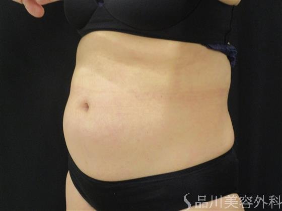 症例NO.52094のBEFORE写真