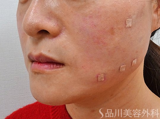 症例NO.73698のAFTER写真