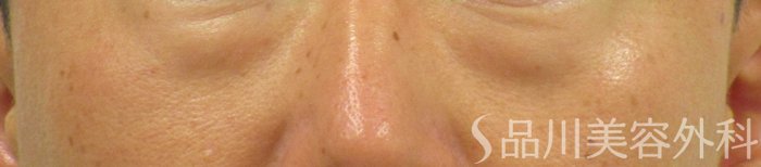 症例NO.65128のBEFORE写真