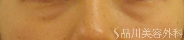 症例NO.65064のBEFORE写真