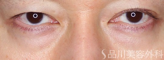 症例NO.73572のBEFORE写真