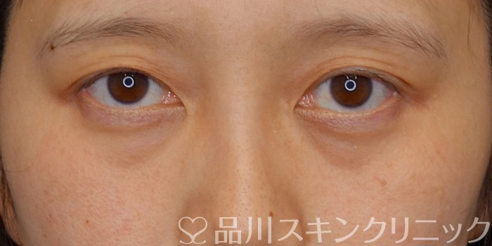 症例NO.73069のBEFORE写真