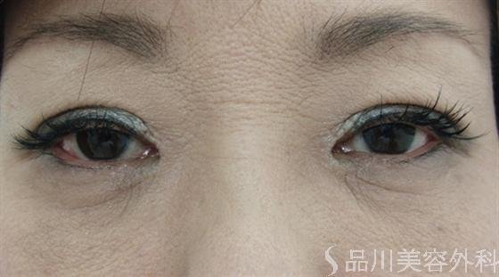 症例NO.7127のAFTER写真