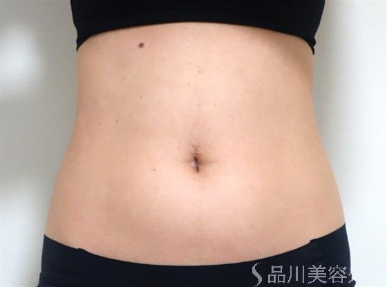症例NO.35000のBEFORE写真