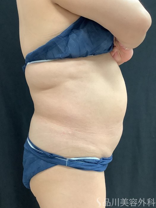 症例NO.67835のBEFORE写真