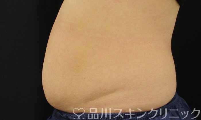 症例NO.74659のBEFORE写真